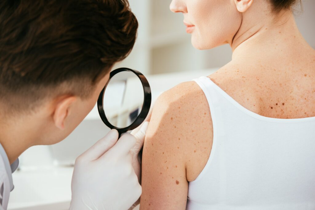 cropped view of dermatologist holding magnifying glass while examining patient with skin disease