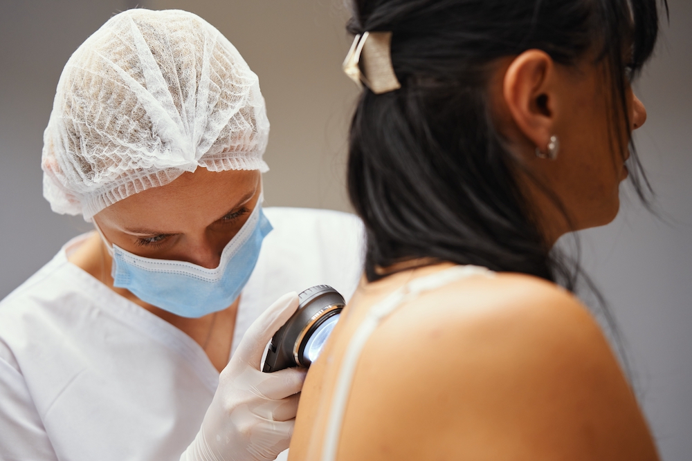 skin cancer is common in the tropics. cairns telehealth service