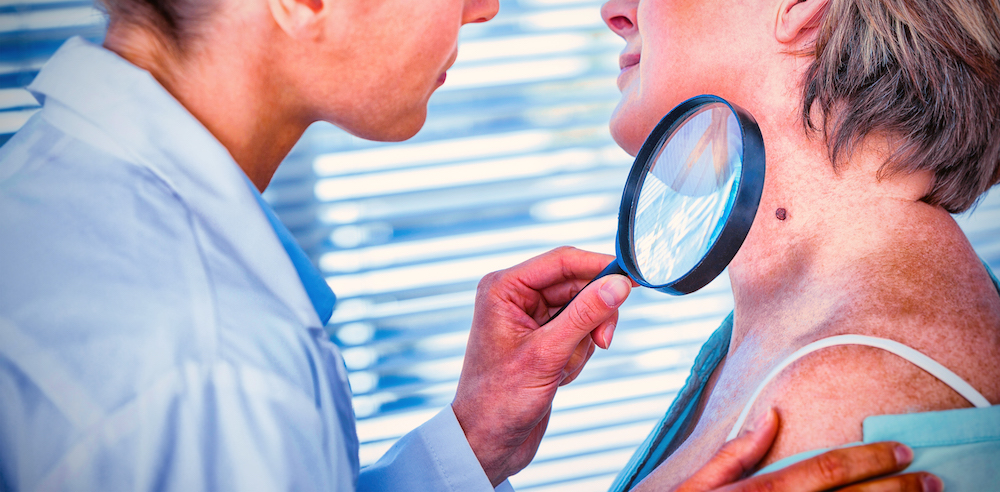 Dermatologist examining mole with magnifying glass in clinic
finding a dermatologist in Australia