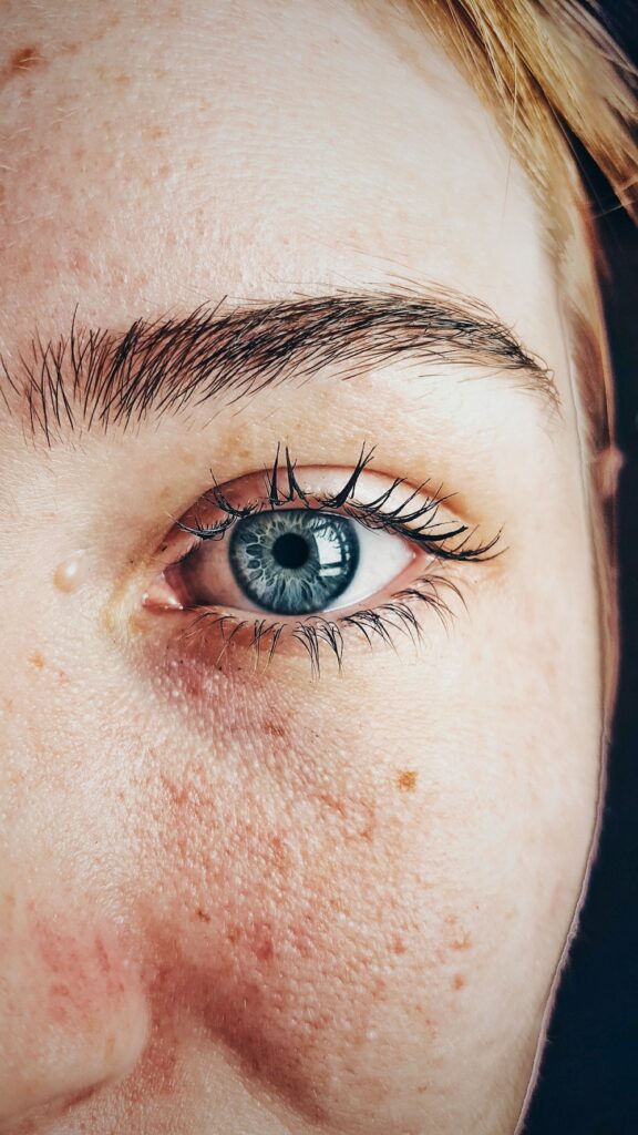 Tele-Dermatology for Skin Cancer Detection and Prevention in Australia